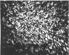 speckles.jpg (34625 octets)