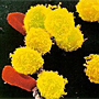Lymphocytes. Photo CNRI.